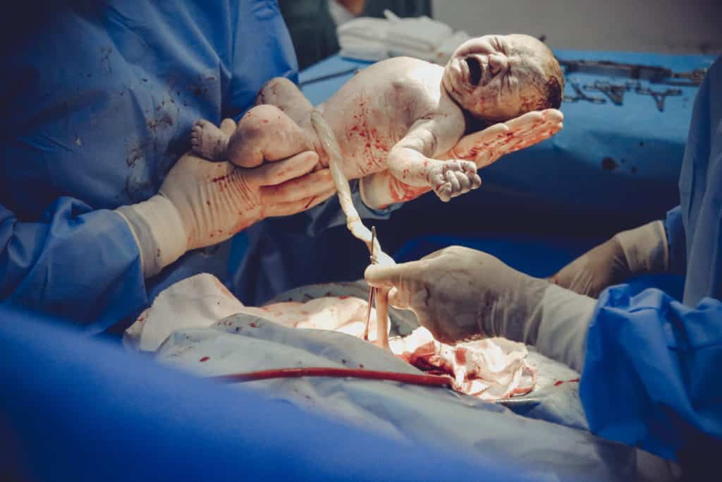 Once your baby is born and placenta delivery, ghe incisions made during the Caesarean section are stitched closed