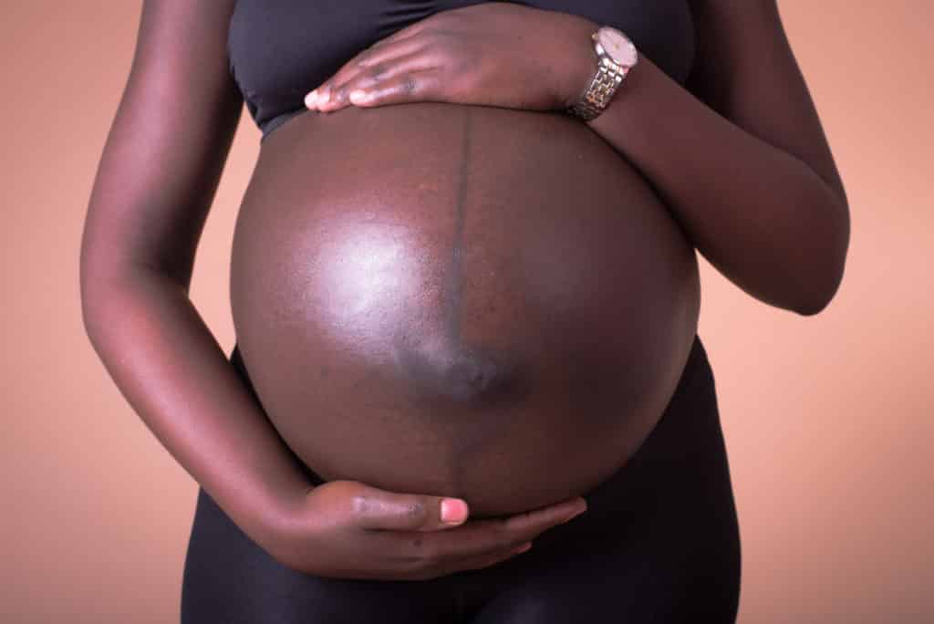Caesarian sections are offered to pregnant mums for a host of reasons