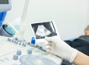 How to diagnose placenta previa
