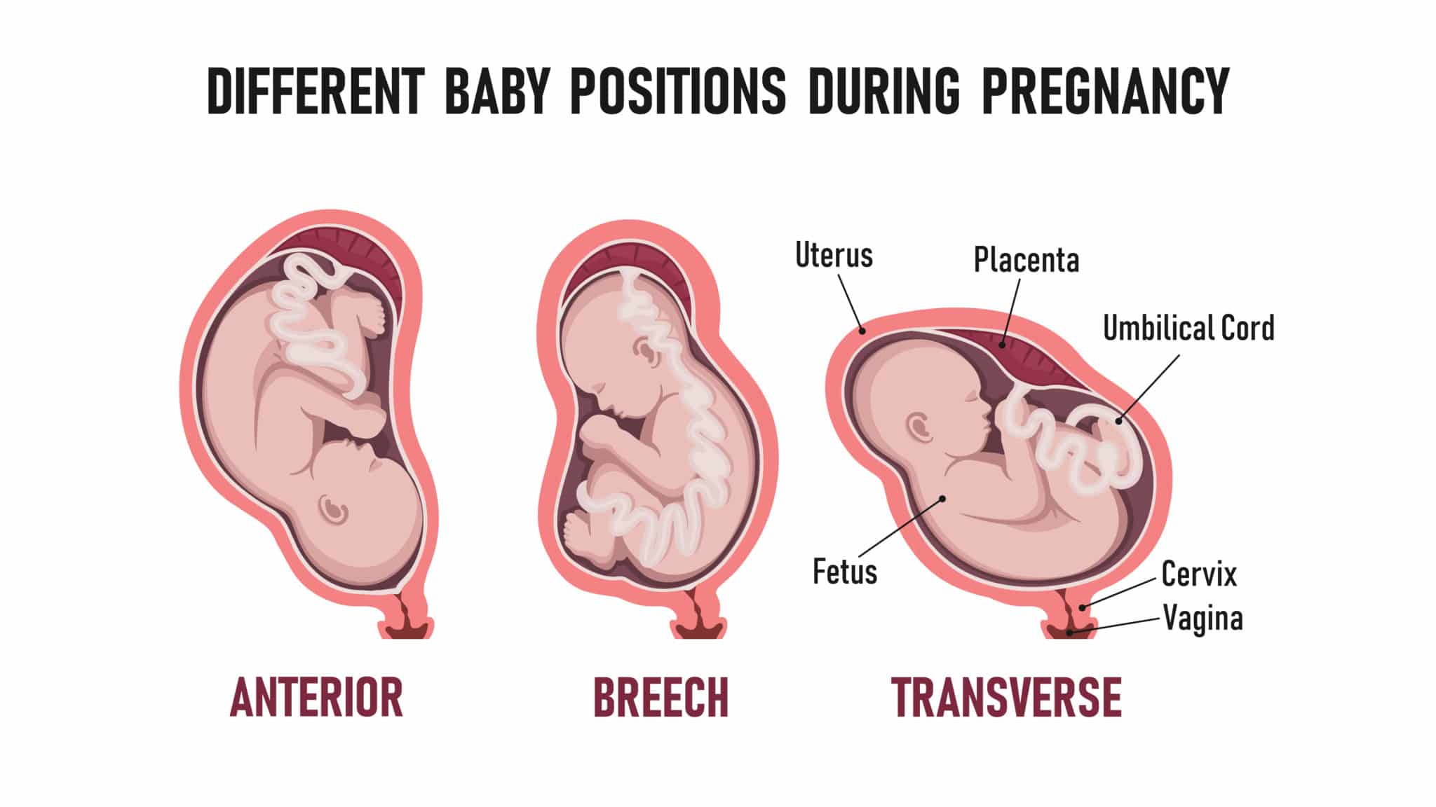 transverse presentation of fetus