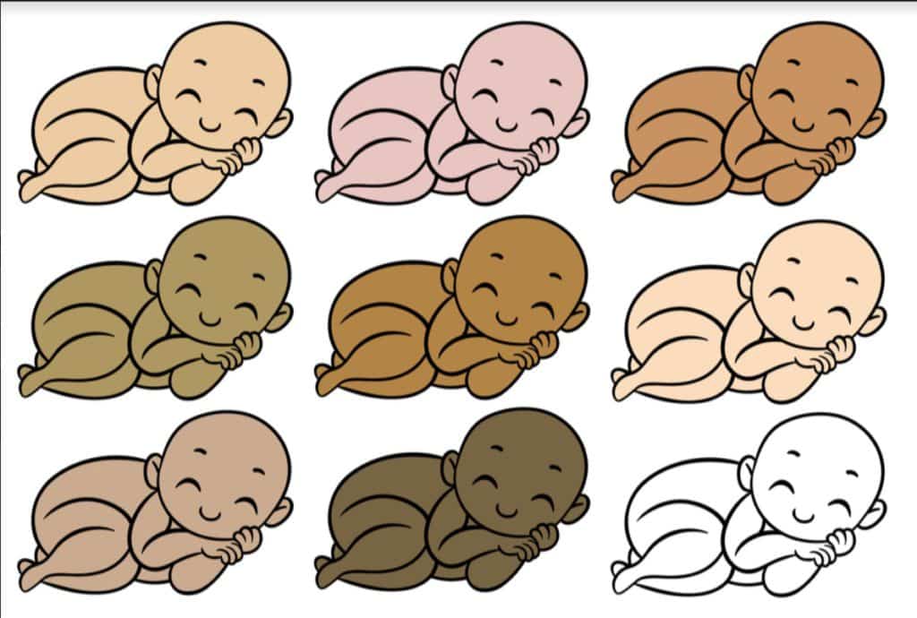 how to determine your baby's skin color
